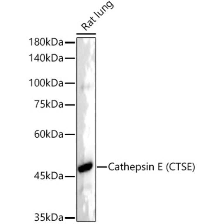 Western Blot - Anti-Cathepsin E Antibody [ARC55299] (A306096) - Antibodies.com