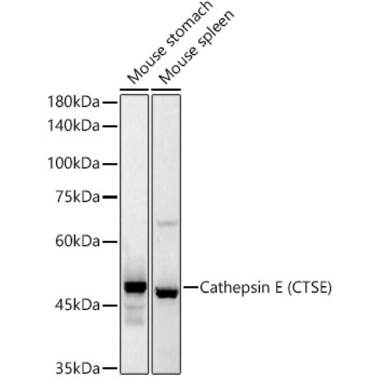 Western Blot - Anti-Cathepsin E Antibody [ARC55299] (A306096) - Antibodies.com