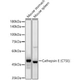 Western Blot - Anti-Cathepsin E Antibody [ARC55299] (A306096) - Antibodies.com