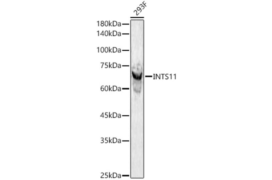 Western Blot - Anti-INTS11 Antibody (A306097) - Antibodies.com
