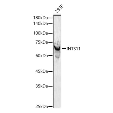 Western Blot - Anti-INTS11 Antibody (A306097) - Antibodies.com