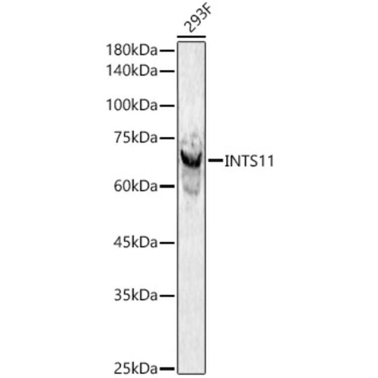 Western Blot - Anti-INTS11 Antibody (A306097) - Antibodies.com