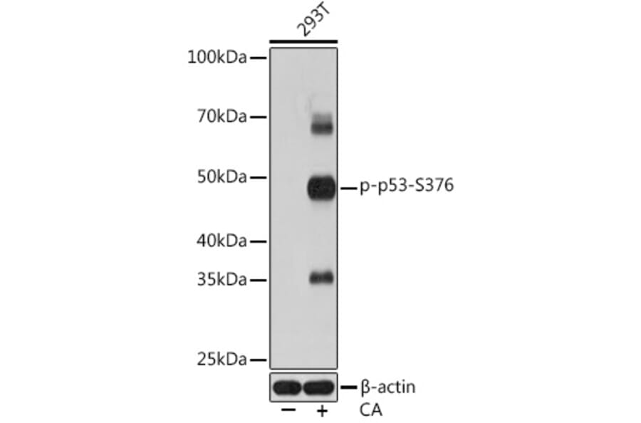 Western Blot - Anti-p53 (phospho Ser376) Antibody [ARC1531] (A306098) - Antibodies.com