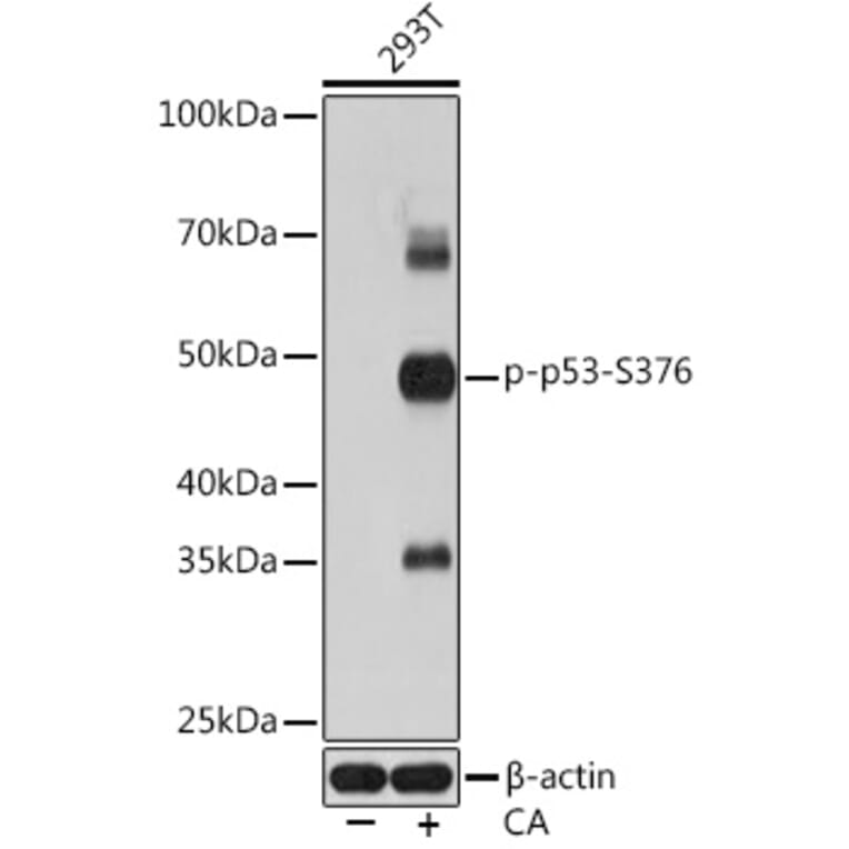 Western Blot - Anti-p53 (phospho Ser376) Antibody [ARC1531] (A306098) - Antibodies.com