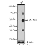 Western Blot - Anti-p53 (phospho Ser376) Antibody [ARC1531] (A306098) - Antibodies.com