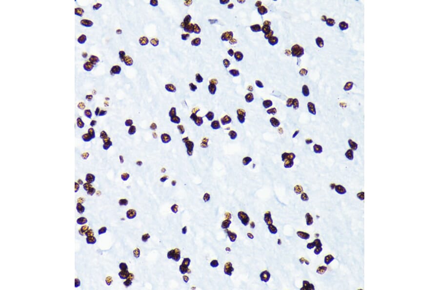Immunohistochemistry - Anti-Histone H4 (acetyl Lys5) Antibody [ARC0002] (A306100) - Antibodies.com