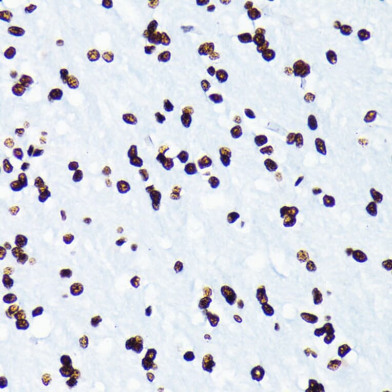Immunohistochemistry - Anti-Histone H4 (acetyl Lys5) Antibody [ARC0002] (A306100) - Antibodies.com