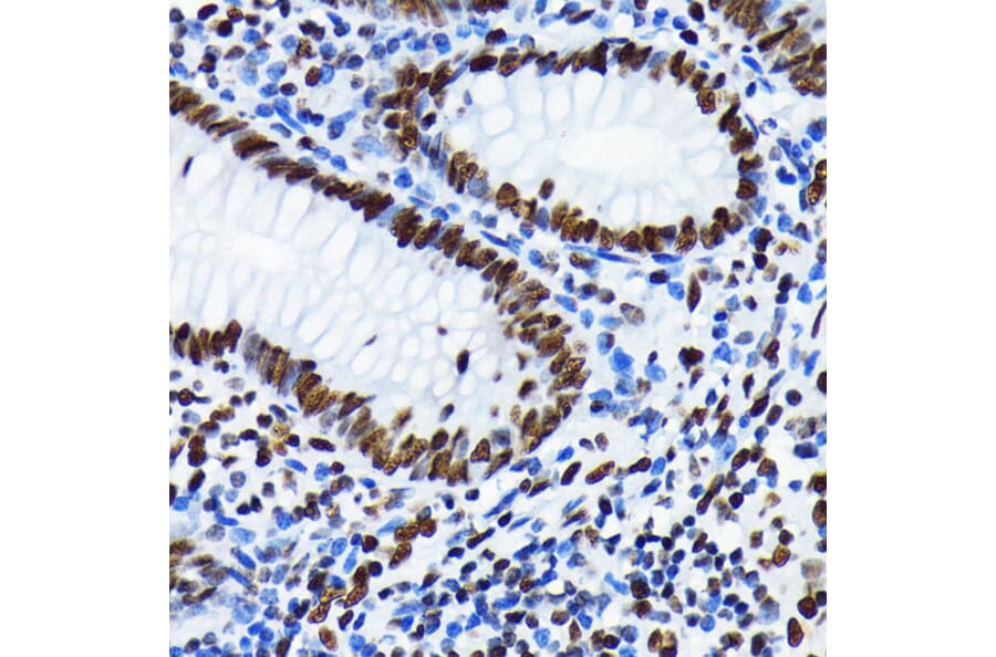 Immunohistochemistry - Anti-Histone H4 (acetyl Lys5) Antibody [ARC0002] (A306100) - Antibodies.com