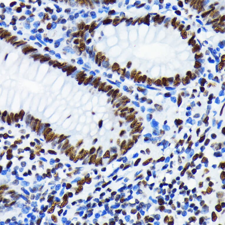 Immunohistochemistry - Anti-Histone H4 (acetyl Lys5) Antibody [ARC0002] (A306100) - Antibodies.com