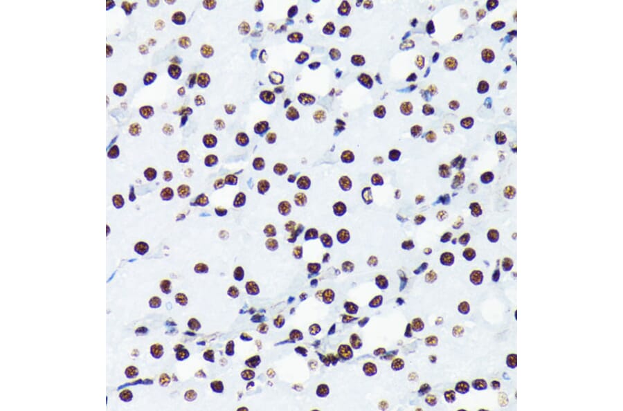 Immunohistochemistry - Anti-Histone H4 (acetyl Lys5) Antibody [ARC0002] (A306100) - Antibodies.com
