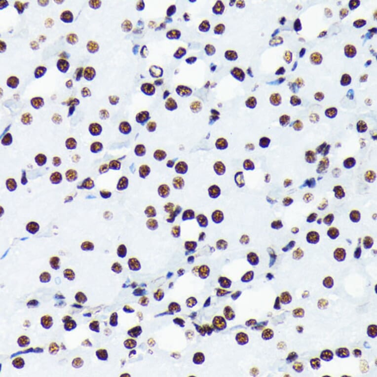 Immunohistochemistry - Anti-Histone H4 (acetyl Lys5) Antibody [ARC0002] (A306100) - Antibodies.com