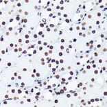 Immunohistochemistry - Anti-Histone H4 (acetyl Lys5) Antibody [ARC0002] (A306100) - Antibodies.com