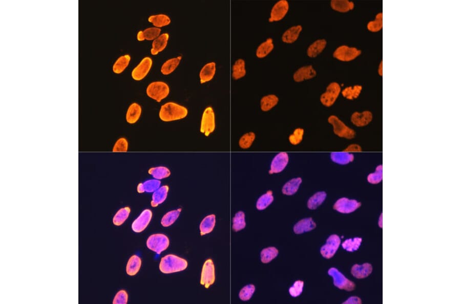 Immunofluorescence - Anti-Histone H4 (acetyl Lys5) Antibody [ARC0002] (A306100) - Antibodies.com