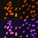 Immunofluorescence - Anti-Histone H4 (acetyl Lys5) Antibody [ARC0002] (A306100) - Antibodies.com