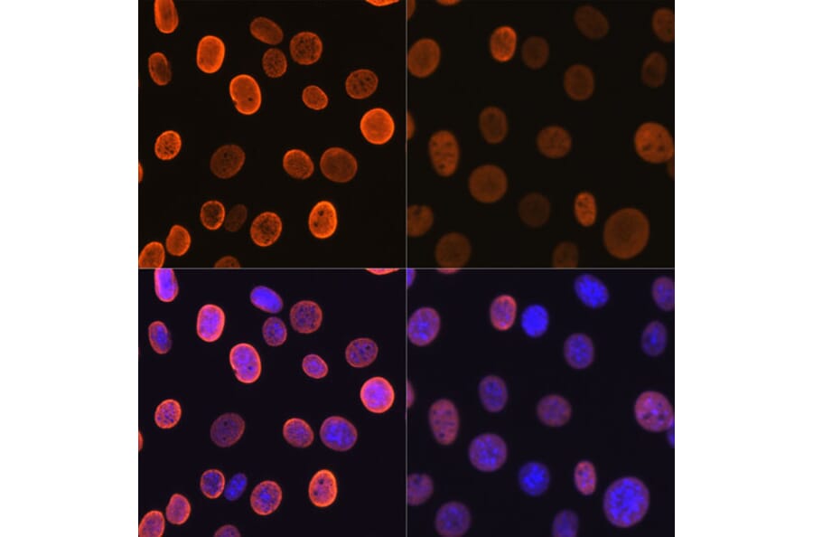 Immunofluorescence - Anti-Histone H4 (acetyl Lys5) Antibody [ARC0002] (A306100) - Antibodies.com