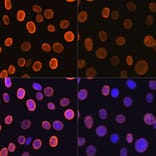 Immunofluorescence - Anti-Histone H4 (acetyl Lys5) Antibody [ARC0002] (A306100) - Antibodies.com