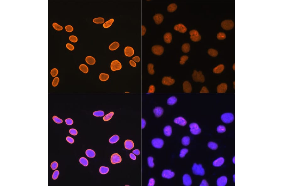 Immunofluorescence - Anti-Histone H4 (acetyl Lys5) Antibody [ARC0002] (A306100) - Antibodies.com
