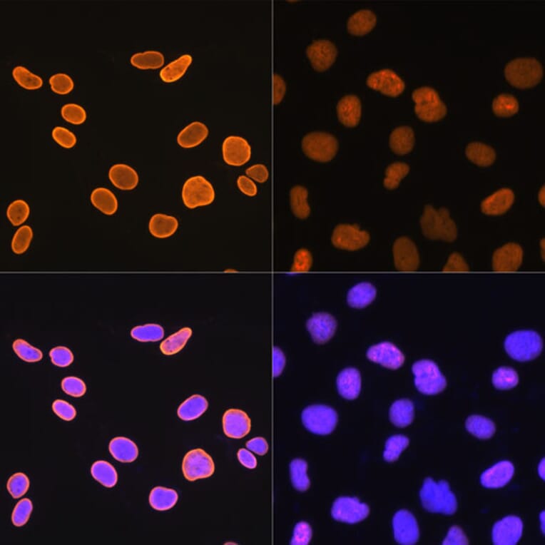 Immunofluorescence - Anti-Histone H4 (acetyl Lys5) Antibody [ARC0002] (A306100) - Antibodies.com