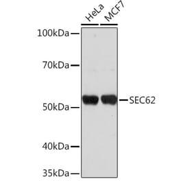 Western Blot - Anti-SEC62 Antibody (A306102) - Antibodies.com