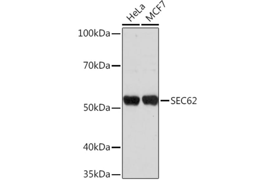 Western Blot - Anti-SEC62 Antibody (A306102) - Antibodies.com