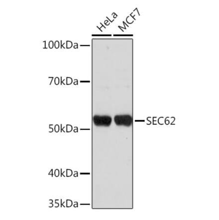 Western Blot - Anti-SEC62 Antibody (A306102) - Antibodies.com