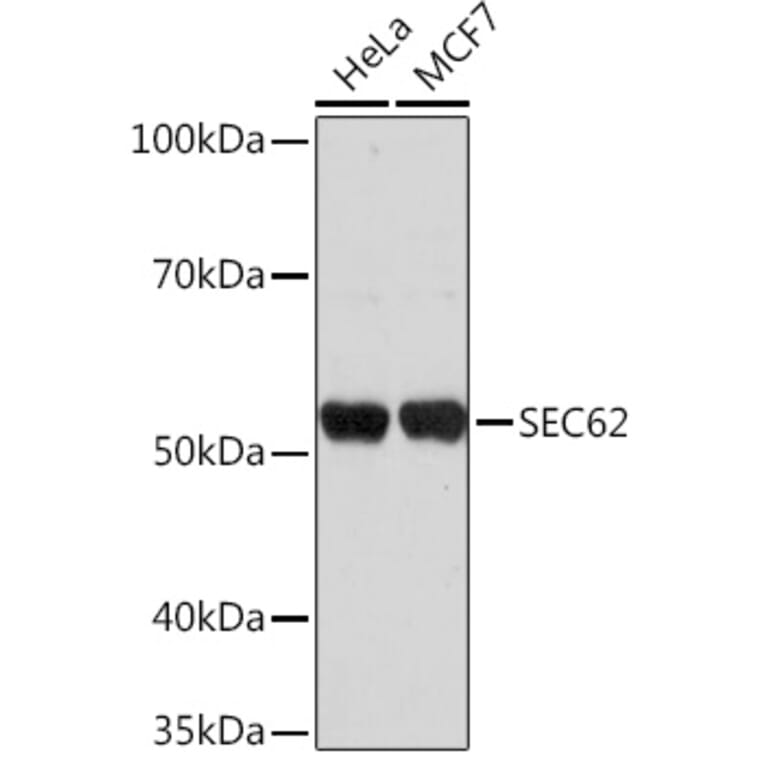 Western Blot - Anti-SEC62 Antibody (A306102) - Antibodies.com