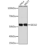 Western Blot - Anti-SEC62 Antibody (A306102) - Antibodies.com