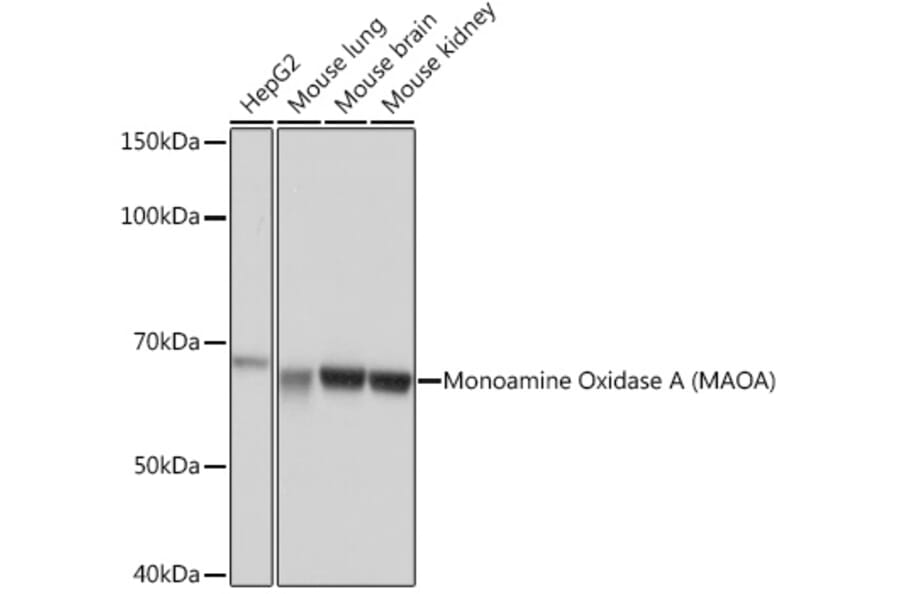 Western Blot - Anti-Monoamine Oxidase A/MAO-A Antibody [ARC0900] (A306103) - Antibodies.com