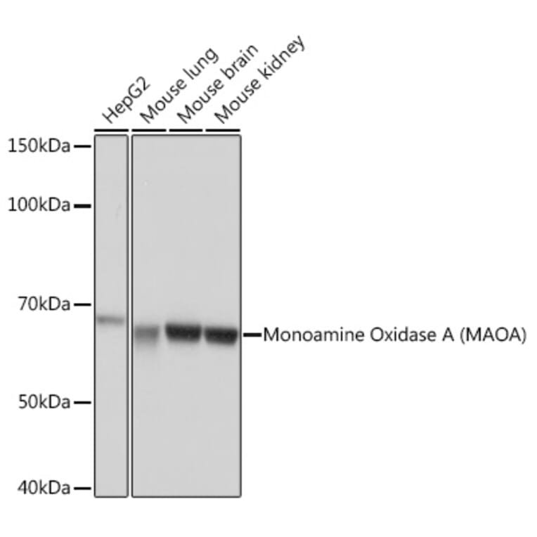 Western Blot - Anti-Monoamine Oxidase A/MAO-A Antibody [ARC0900] (A306103) - Antibodies.com