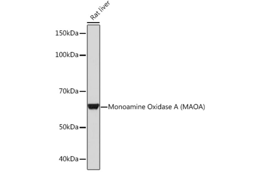Western Blot - Anti-Monoamine Oxidase A/MAO-A Antibody [ARC0900] (A306103) - Antibodies.com