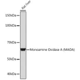 Western Blot - Anti-Monoamine Oxidase A/MAO-A Antibody [ARC0900] (A306103) - Antibodies.com