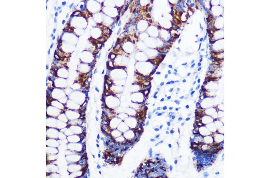 Immunohistochemistry - Anti-Monoamine Oxidase A/MAO-A Antibody [ARC0900] (A306103) - Antibodies.com