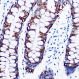 Immunohistochemistry - Anti-Monoamine Oxidase A/MAO-A Antibody [ARC0900] (A306103) - Antibodies.com