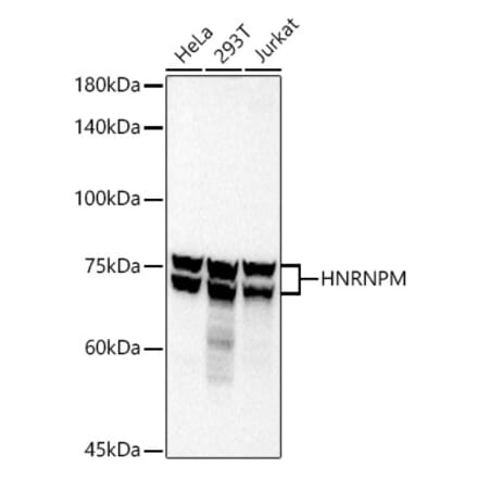 Western Blot - Anti-Heterogeneous nuclear ribonucleoprotein M Antibody [ARC2951] (A306104) - Antibodies.com