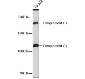 Western Blot - Anti-C3 Antibody [ARC0541] (A306105) - Antibodies.com