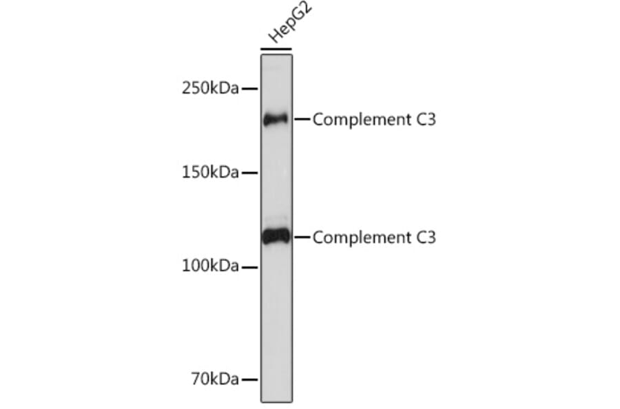 Western Blot - Anti-C3 Antibody [ARC0541] (A306105) - Antibodies.com