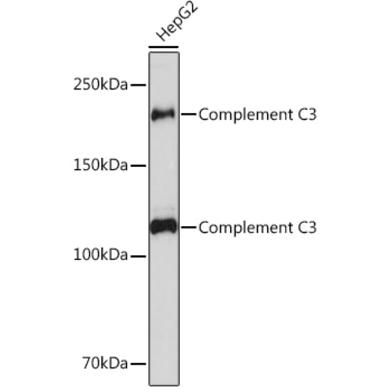 Western Blot - Anti-C3 Antibody [ARC0541] (A306105) - Antibodies.com