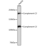 Western Blot - Anti-C3 Antibody [ARC0541] (A306105) - Antibodies.com