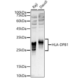 Western Blot - Anti-MHC Class II beta Antibody (A306106) - Antibodies.com