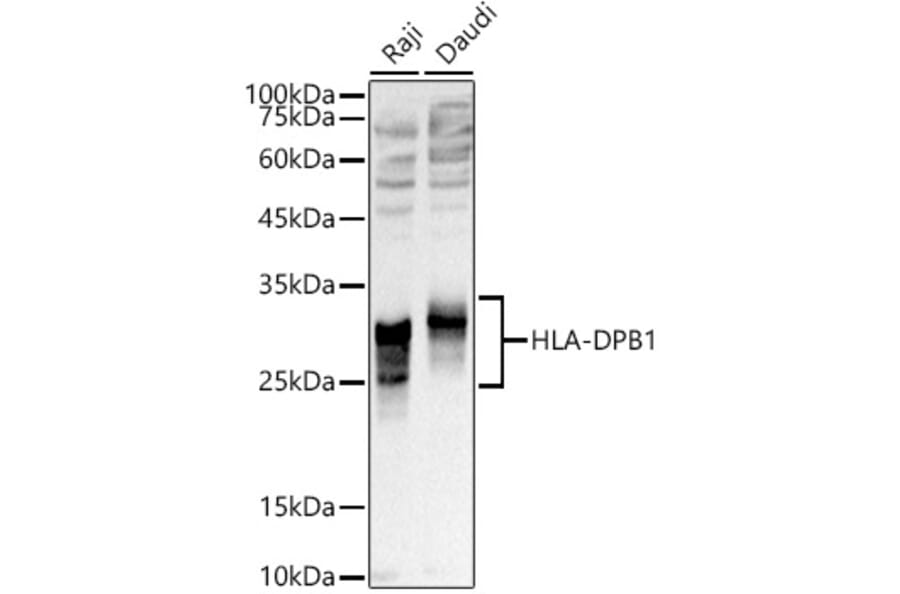 Western Blot - Anti-MHC Class II beta Antibody (A306106) - Antibodies.com