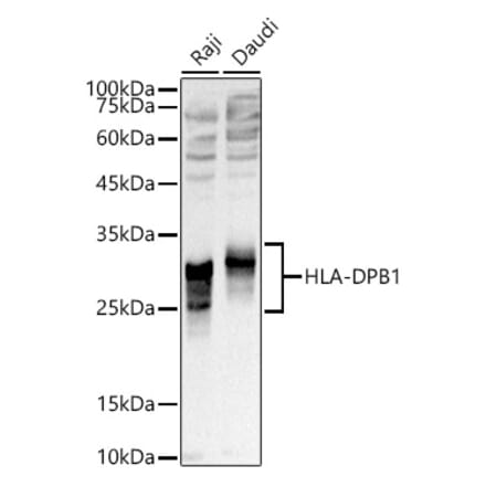 Western Blot - Anti-MHC Class II beta Antibody (A306106) - Antibodies.com