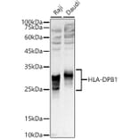 Western Blot - Anti-MHC Class II beta Antibody (A306106) - Antibodies.com