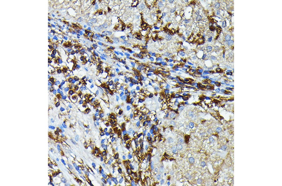 Immunohistochemistry - Anti-MHC Class II beta Antibody (A306106) - Antibodies.com