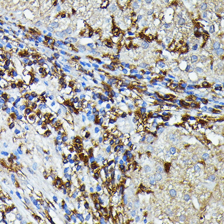 Immunohistochemistry - Anti-MHC Class II beta Antibody (A306106) - Antibodies.com