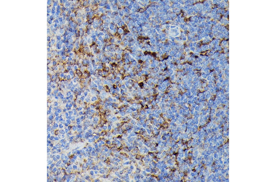 Immunohistochemistry - Anti-MHC Class II beta Antibody (A306106) - Antibodies.com