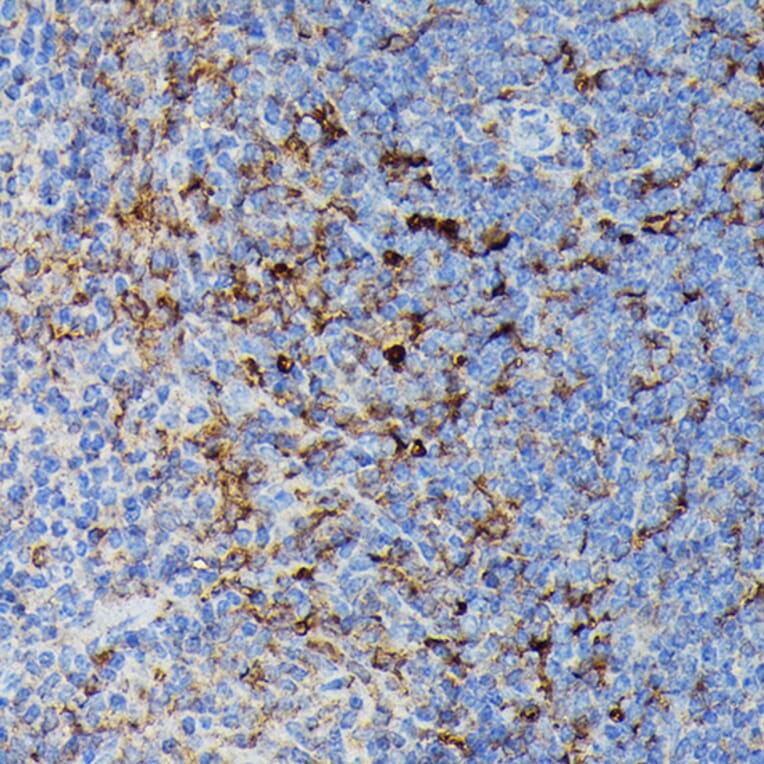 Immunohistochemistry - Anti-MHC Class II beta Antibody (A306106) - Antibodies.com