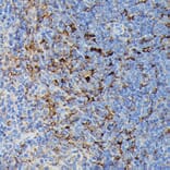 Immunohistochemistry - Anti-MHC Class II beta Antibody (A306106) - Antibodies.com