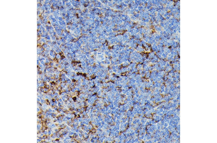 Immunohistochemistry - Anti-MHC Class II beta Antibody (A306106) - Antibodies.com
