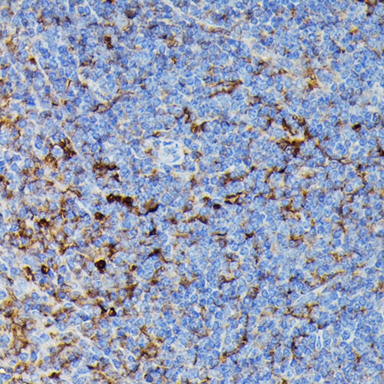 Immunohistochemistry - Anti-MHC Class II beta Antibody (A306106) - Antibodies.com
