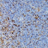 Immunohistochemistry - Anti-MHC Class II beta Antibody (A306106) - Antibodies.com